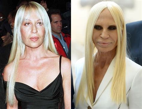 donatella versace di dov'è|donatella versace before and after.